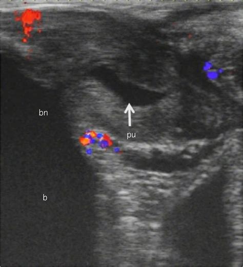 make a man squirt|Male squirting: Analysis of one case using color Doppler .